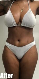 After Image: Circumferential Mamacita Makeover