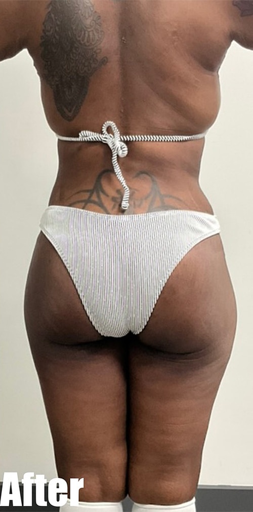 After Image: Circumferential Mamacita Makeover - back