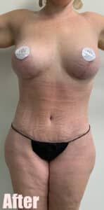 After Image: 43F Circumferential Mamacita Makeover
