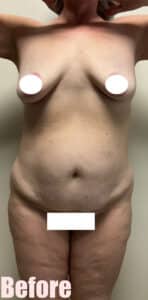Before Image: 43F Circumferential Mamacita Makeover