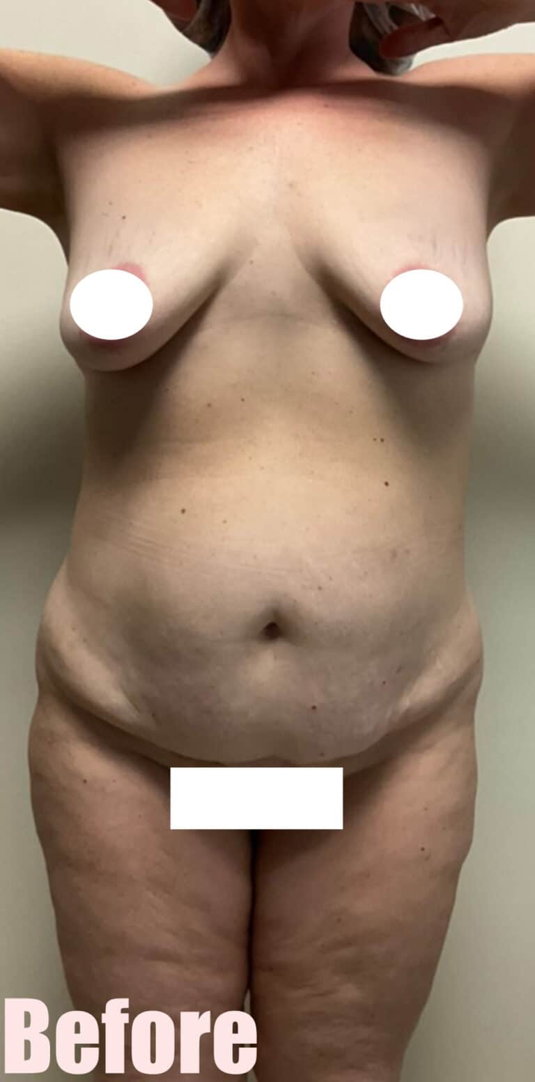 Before Image: 43F Circumferential Mamacita Makeover - front