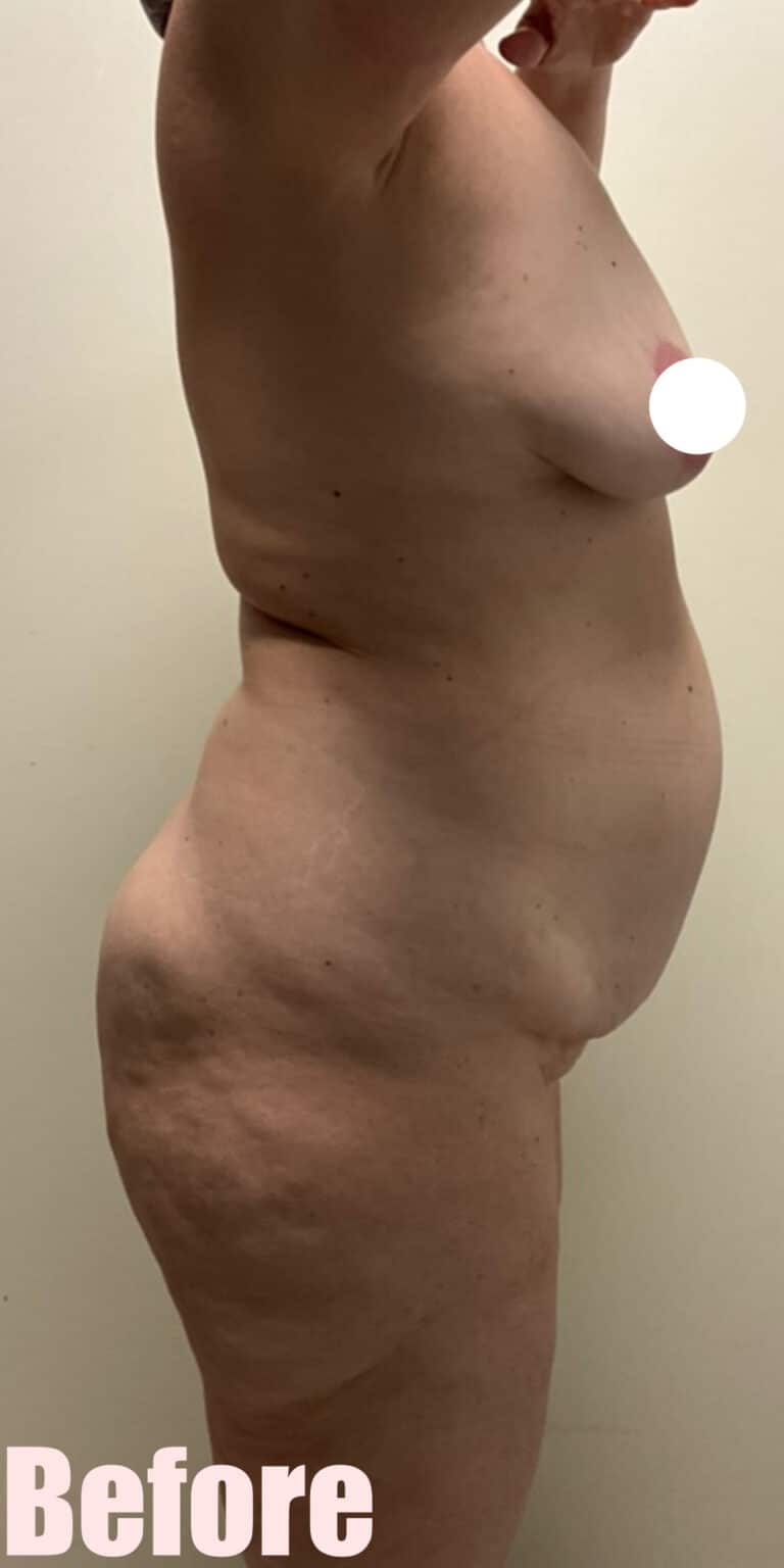 Before Image: 43F Circumferential Mamacita Makeover - right-side