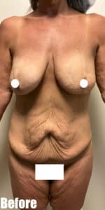 Before Image: Circumferential Mamacita Makeover