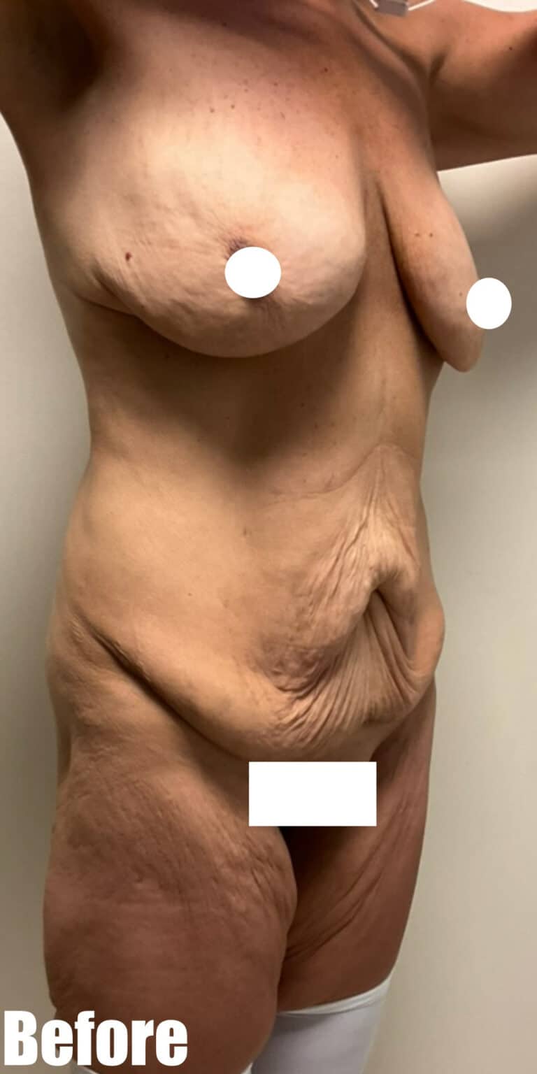 Before Image: Circumferential Mamacita Makeover - right-front-oblique