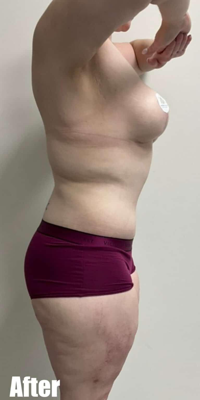 After Image: Circumferential Fleur De Lis - right-side