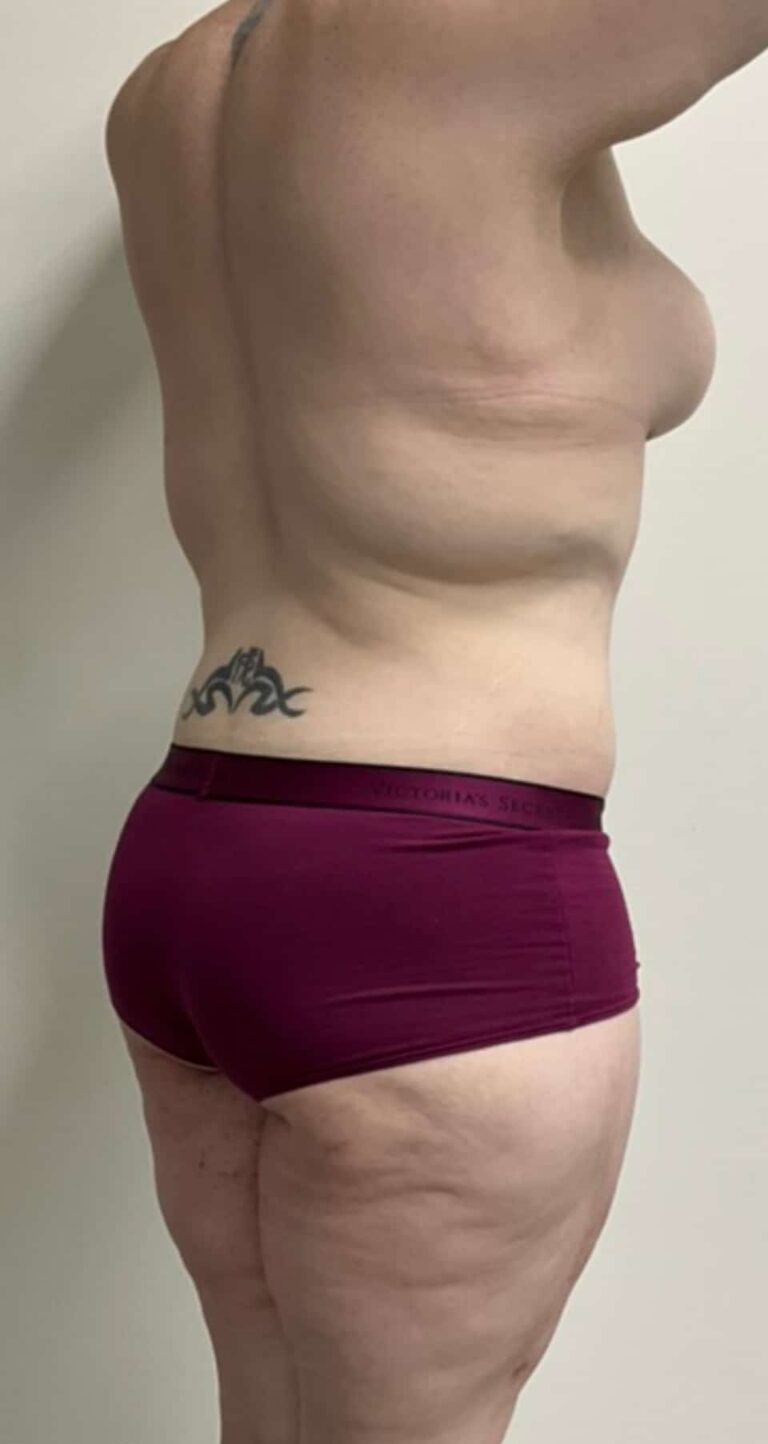 After Image: Circumferential Fleur De Lis - right-back-oblique