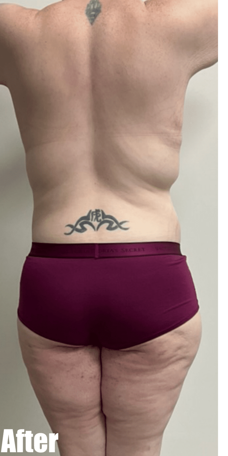 After Image: Circumferential Fleur De Lis - back
