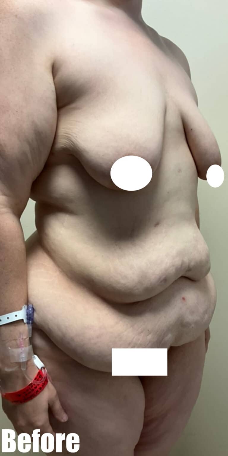 Before Image: Circumferential Fleur De Lis - right-front-oblique