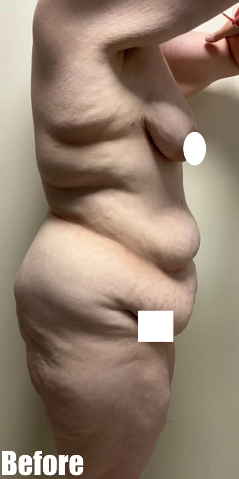 Before Image: Circumferential Fleur De Lis - right-side