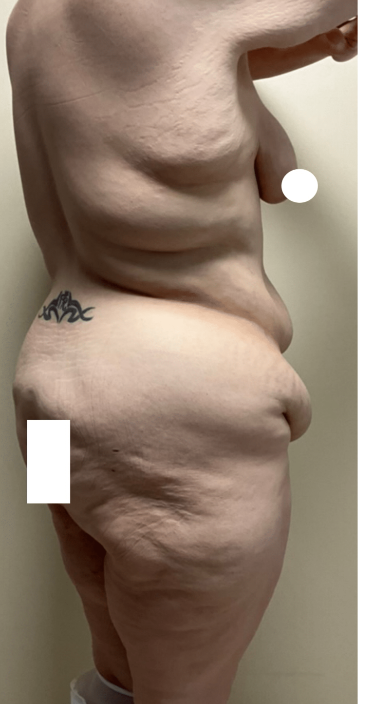 Before Image: Circumferential Fleur De Lis - right-back-oblique