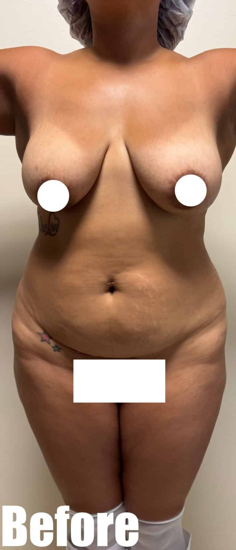 Before Image: Mamacita Makeover - front