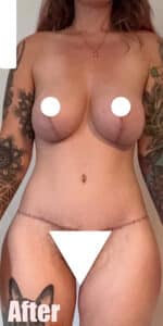 After Image: 29F Circumferential Mamacita Makeover