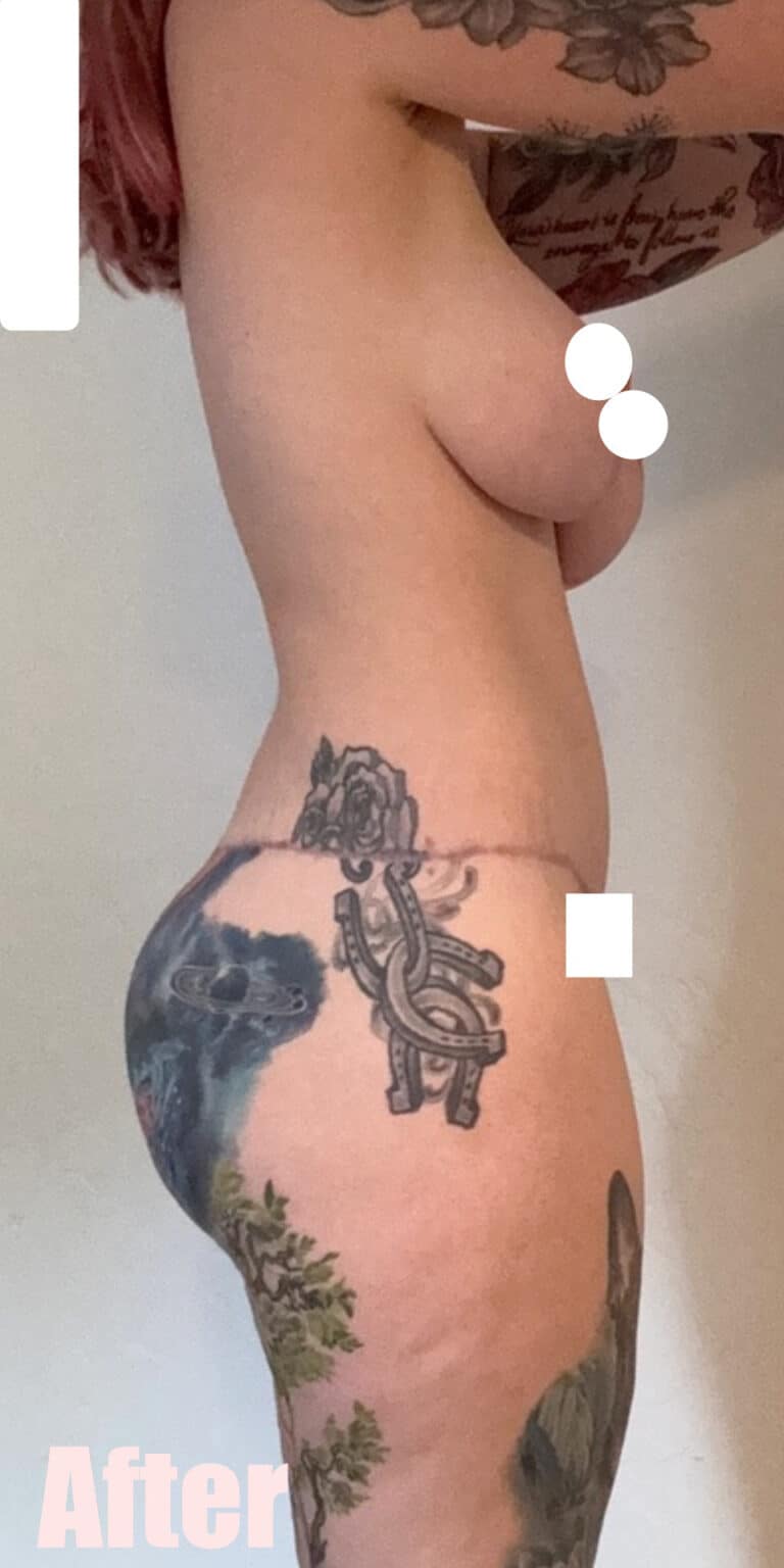 After Image: 29F Circumferential Mamacita Makeover - right-side