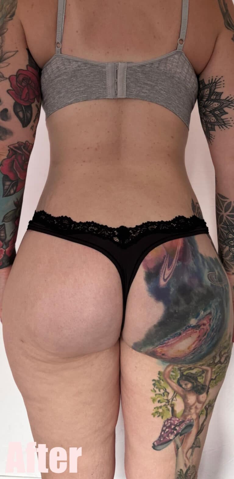 After Image: 29F Circumferential Mamacita Makeover - back