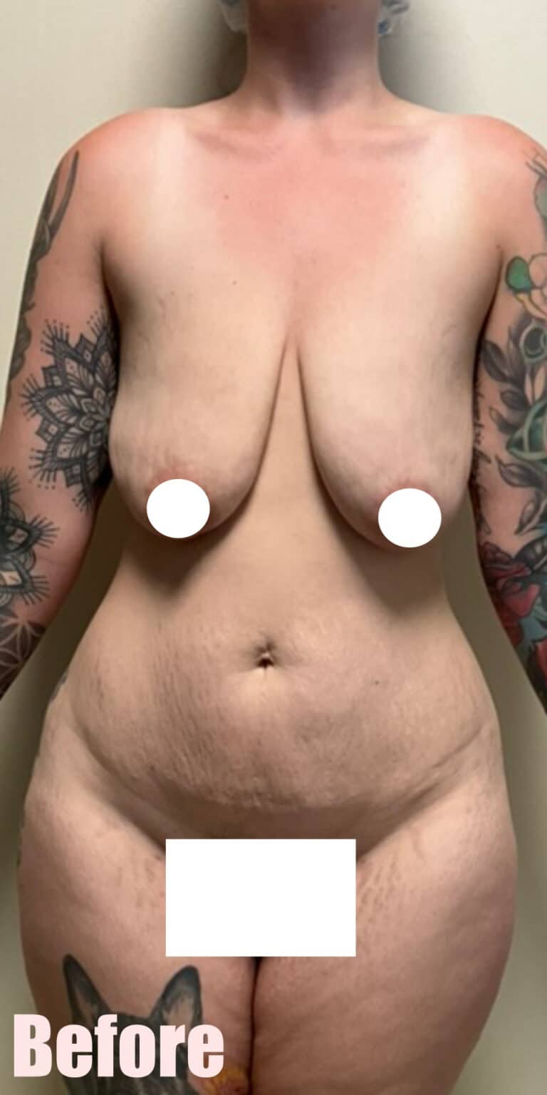 Before Image: 29F Circumferential Mamacita Makeover - front