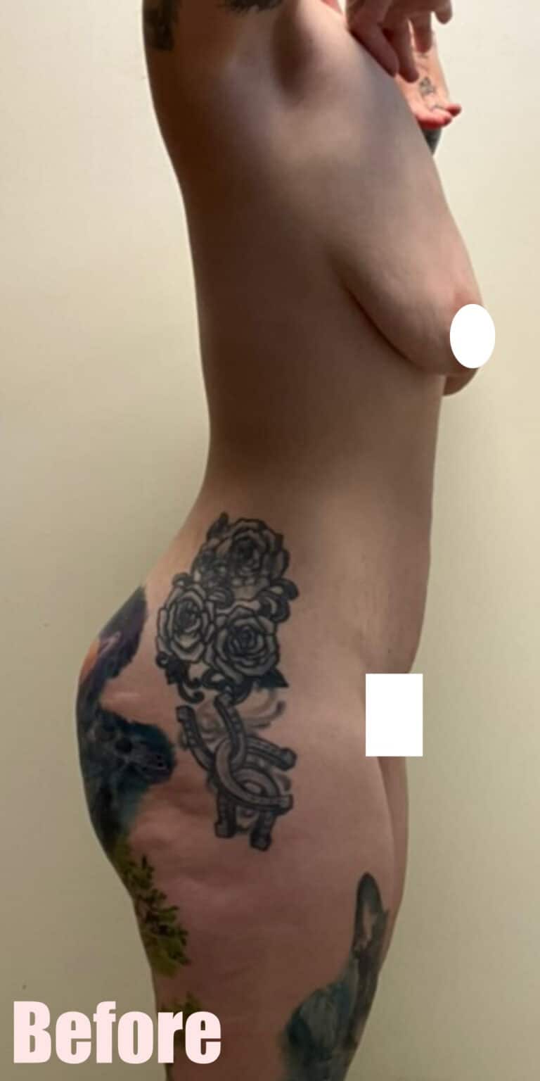 Before Image: 29F Circumferential Mamacita Makeover - right-side