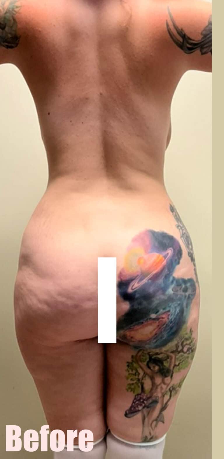 Before Image: 29F Circumferential Mamacita Makeover - back