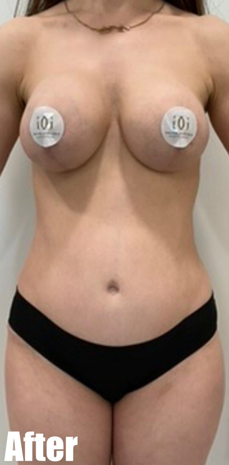 After Image: Mammacita Makeover - front