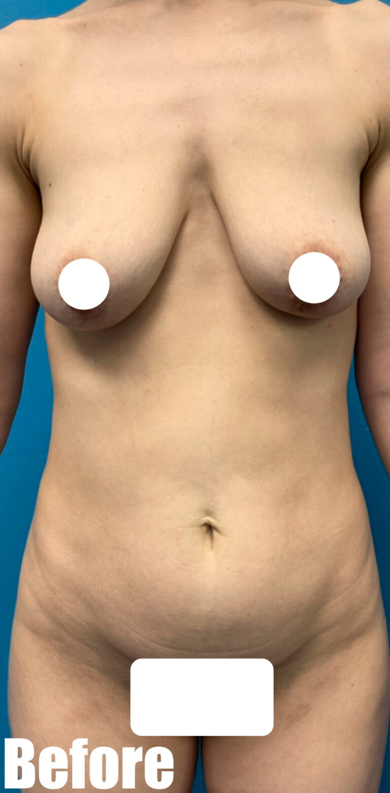 Before Image: Mammacita Makeover - front