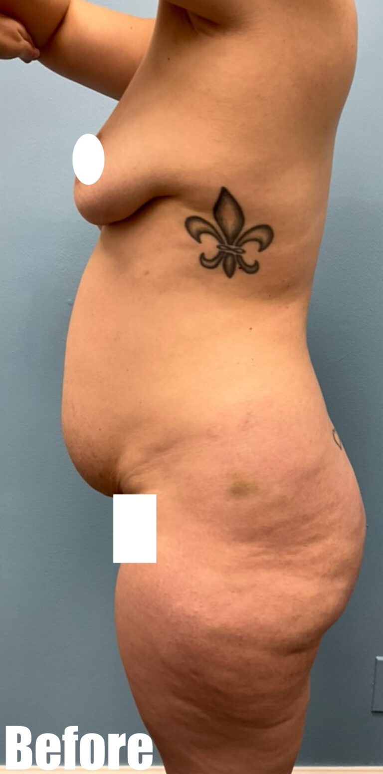 Before Image: Mamacita Makeover - left-side