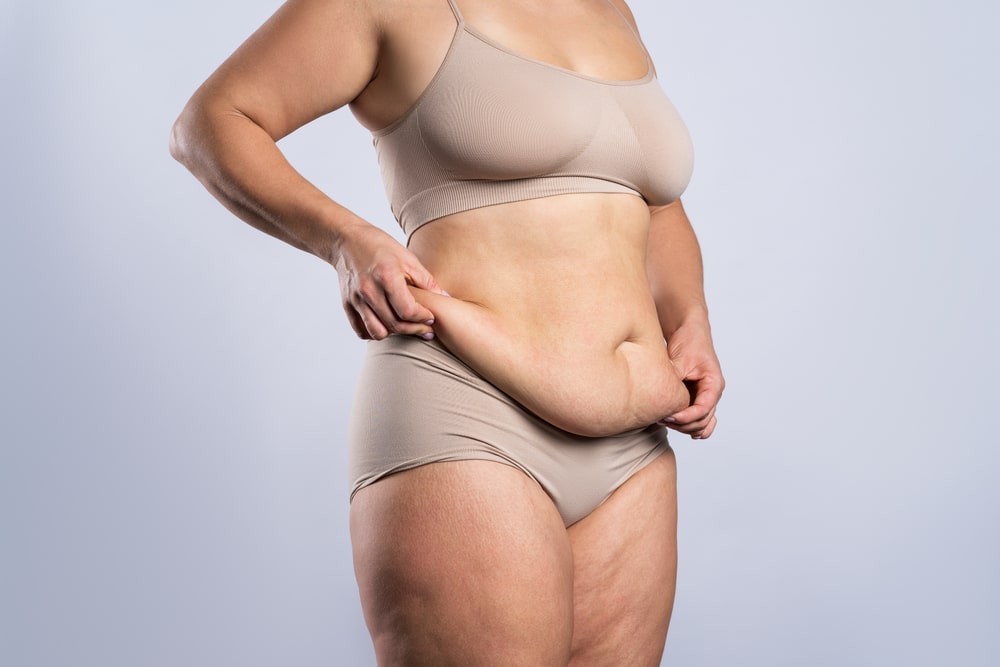 Woman holds folds of belly skin in her hands before a tummy tuck in Boca Raton
