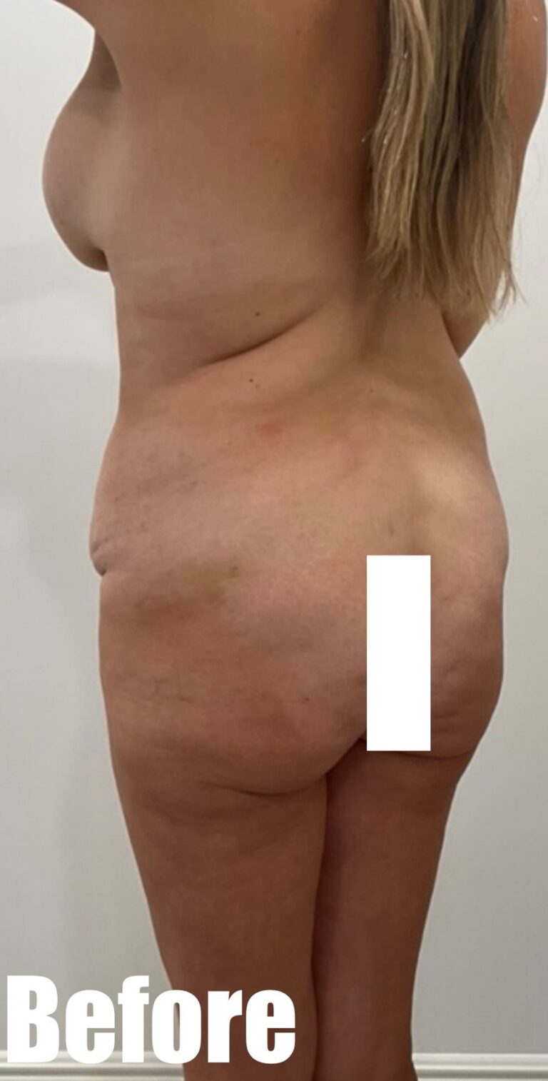 Before Image: Mamacita makeover - left-back-oblique
